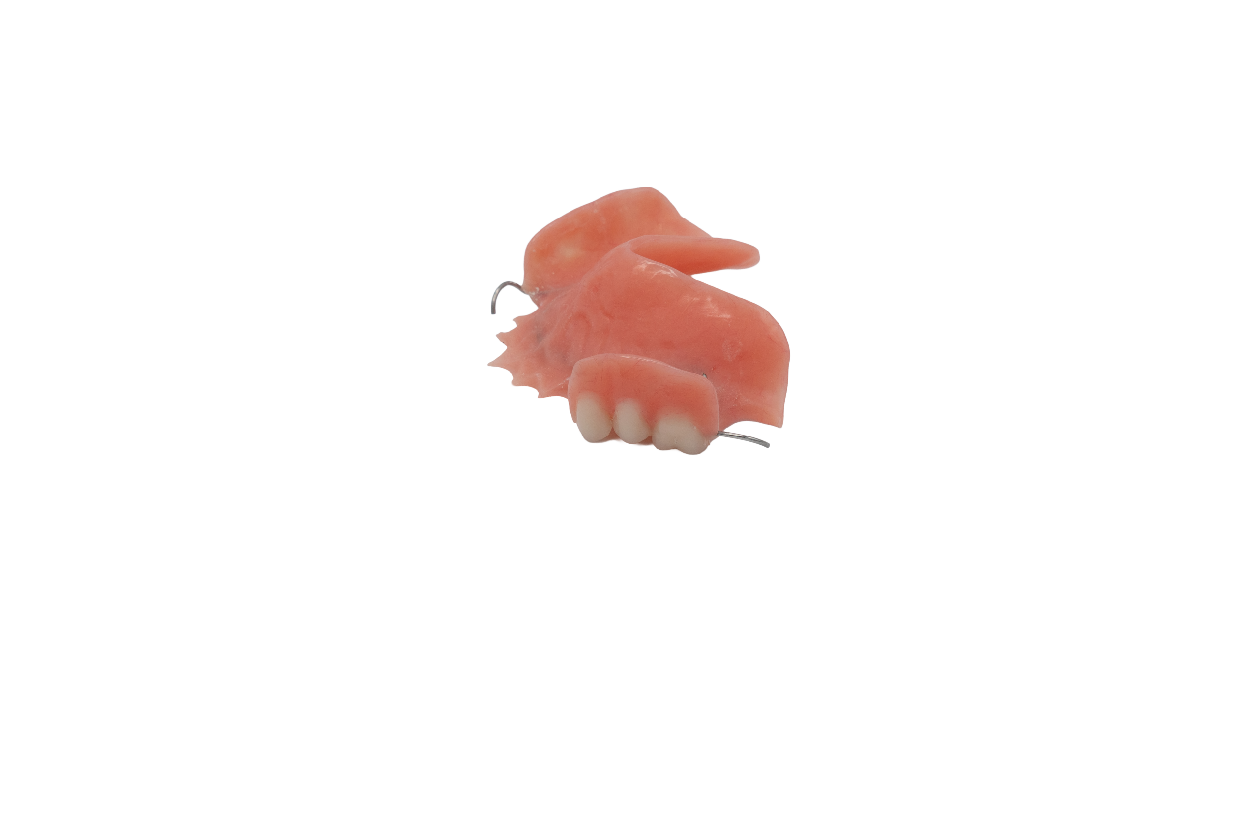 Acrylic Partial Dentures