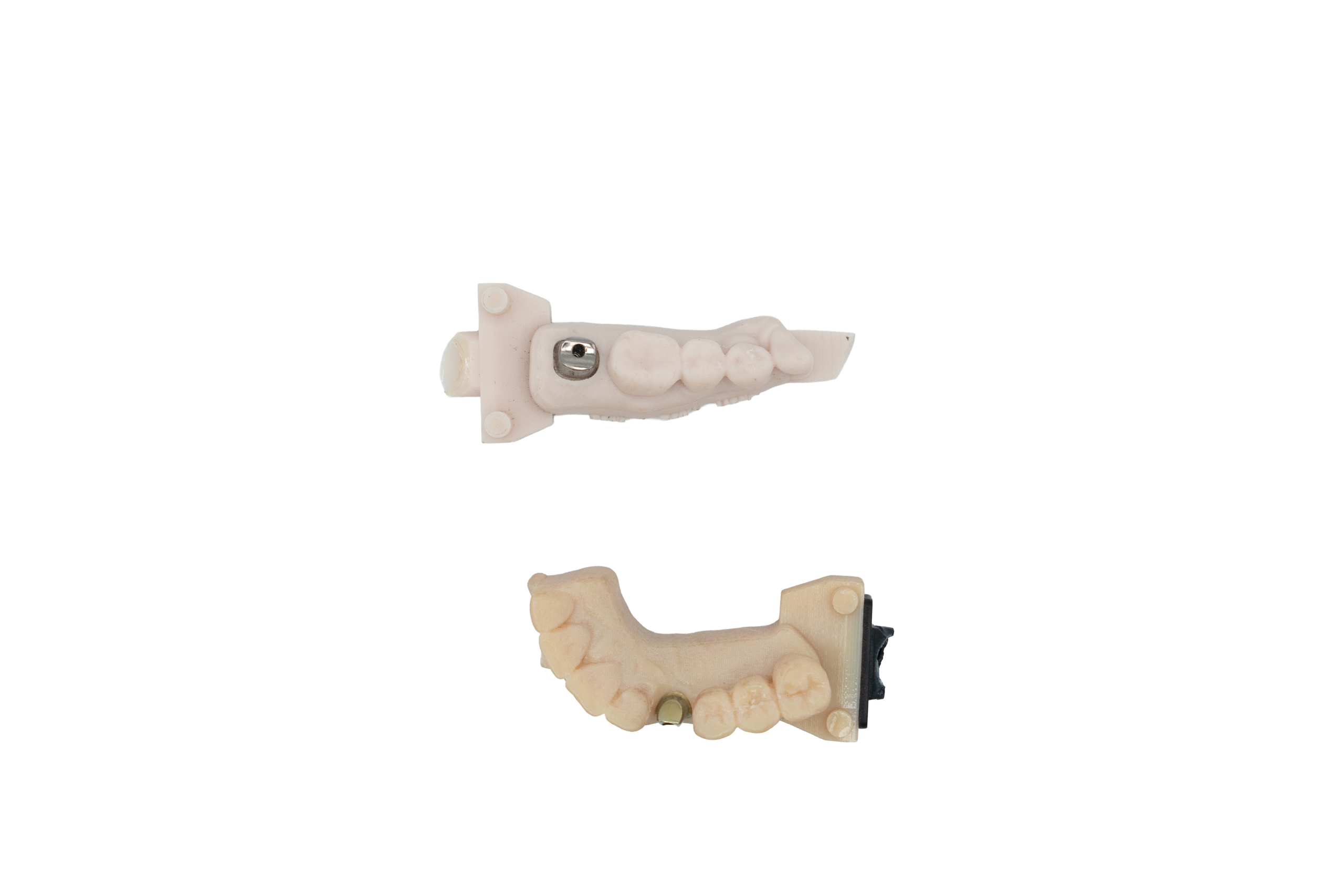 Custom Abutments Crown