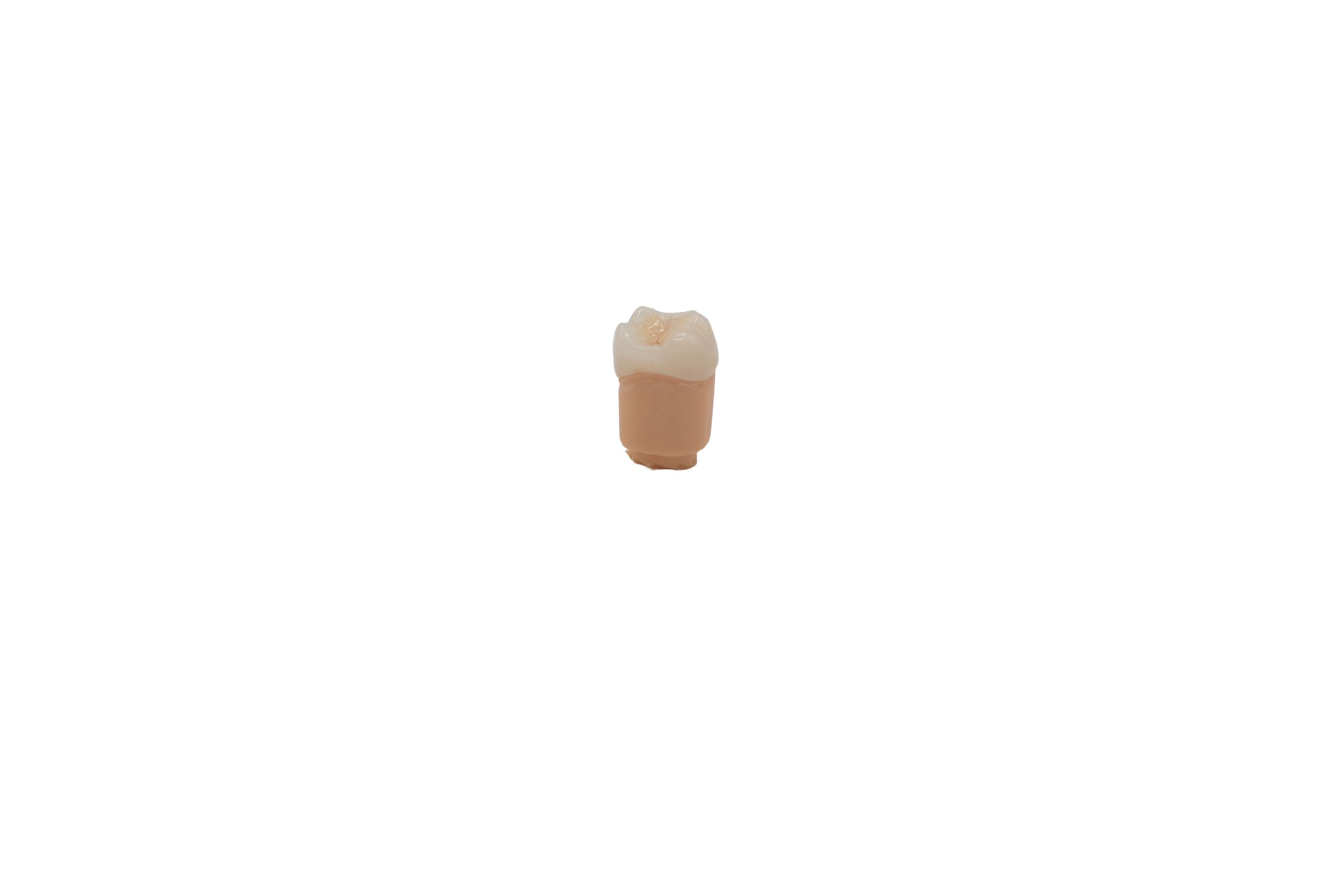 Zirconia Crown